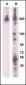 PARK8 (LRRK2) Antibody (L899)